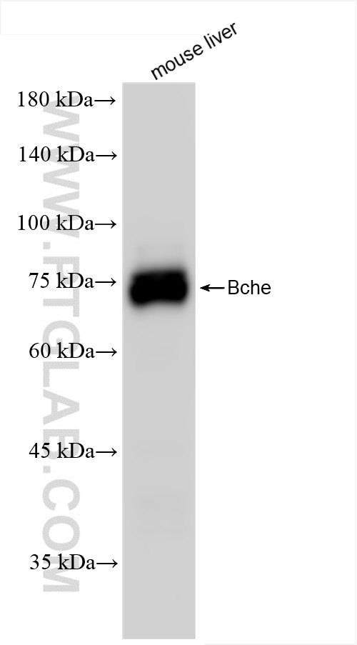 Western Blot (WB) analysis of mouse liver tissue using BCHE Recombinant antibody (85722-4-RR)
