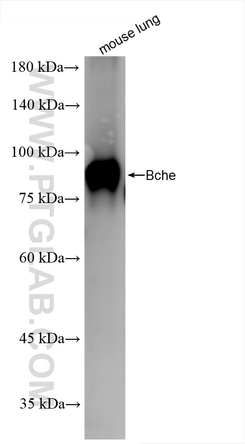 Western Blot (WB) analysis of mouse lung tissue using BCHE Recombinant antibody (85722-4-RR)