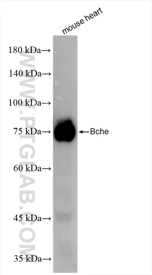 Western Blot (WB) analysis of mouse heart tissue using BCHE Recombinant antibody (85722-4-RR)