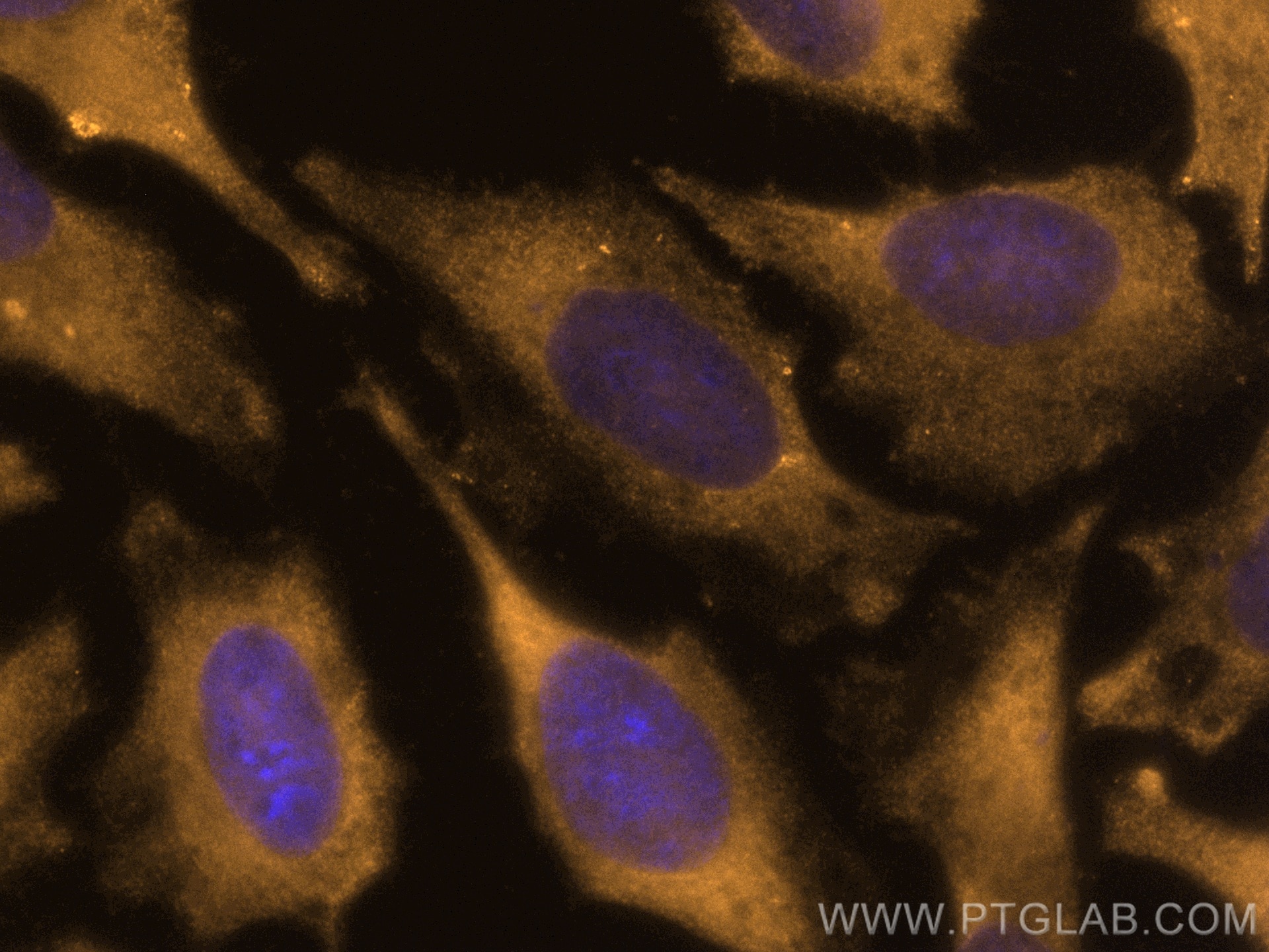 Immunofluorescence (IF) / fluorescent staining of HeLa cells using CoraLite®555-conjugated Bcl-XL Monoclonal antibody (CL555-66020)