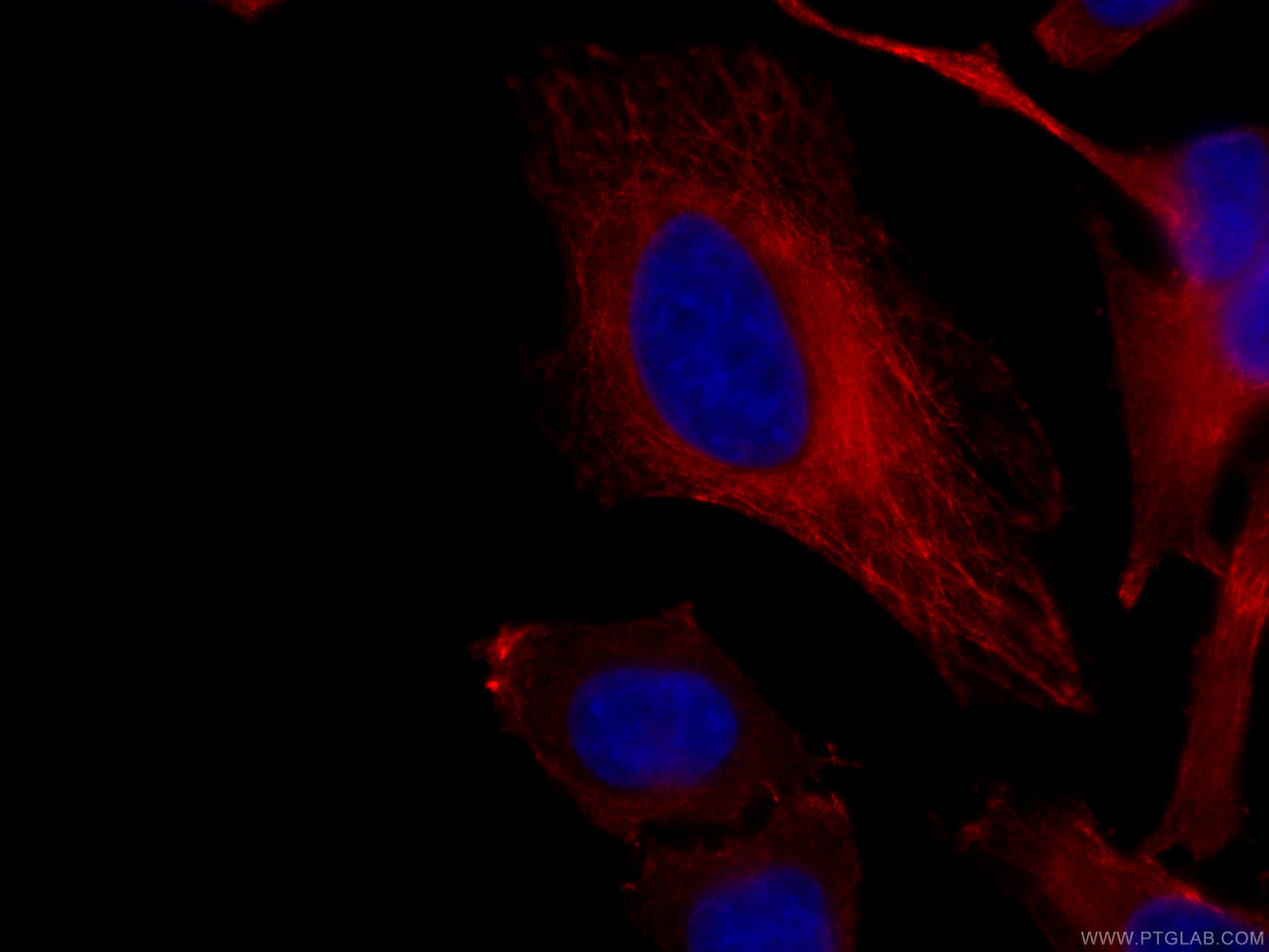 Immunofluorescence (IF) / fluorescent staining of HeLa cells using CoraLite®594-conjugated Bcl-XL Monoclonal antibody (CL594-66020)