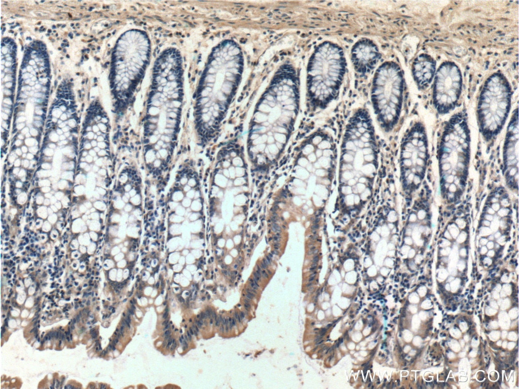 Immunohistochemistry (IHC) staining of human colon tissue using Bcl-XL Polyclonal antibody (10783-1-AP)