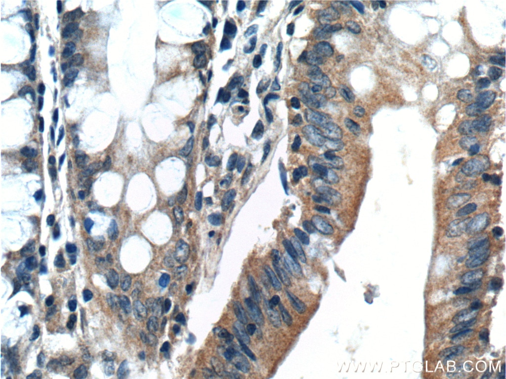 Immunohistochemistry (IHC) staining of human colon tissue using Bcl-XL Polyclonal antibody (10783-1-AP)