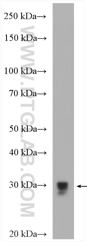 Western Blot (WB) analysis of rat brain tissue using Bcl-XL Polyclonal antibody (10783-1-AP)
