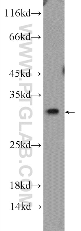 Western Blot (WB) analysis of C6 cells using Bcl-XL Polyclonal antibody (10783-1-AP)