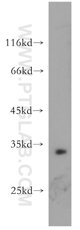 Western Blot (WB) analysis of Raji cells using Bcl-XL Polyclonal antibody (10783-1-AP)