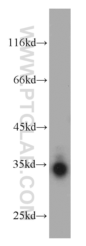 Western Blot (WB) analysis of mouse placenta tissue using Bcl-XL Polyclonal antibody (10783-1-AP)