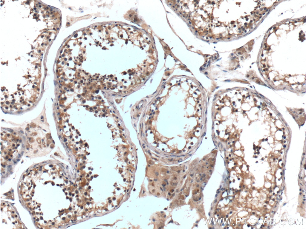 Immunohistochemistry (IHC) staining of human testis tissue using Bcl-XL Polyclonal antibody (26967-1-AP)