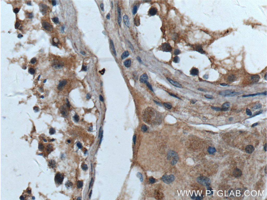 Immunohistochemistry (IHC) staining of human testis tissue using Bcl-XL Polyclonal antibody (26967-1-AP)