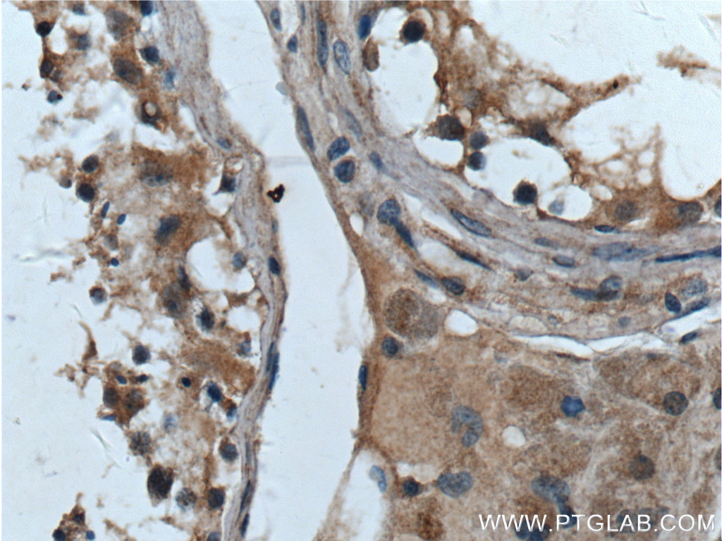 IHC staining of human testis using 26967-1-AP