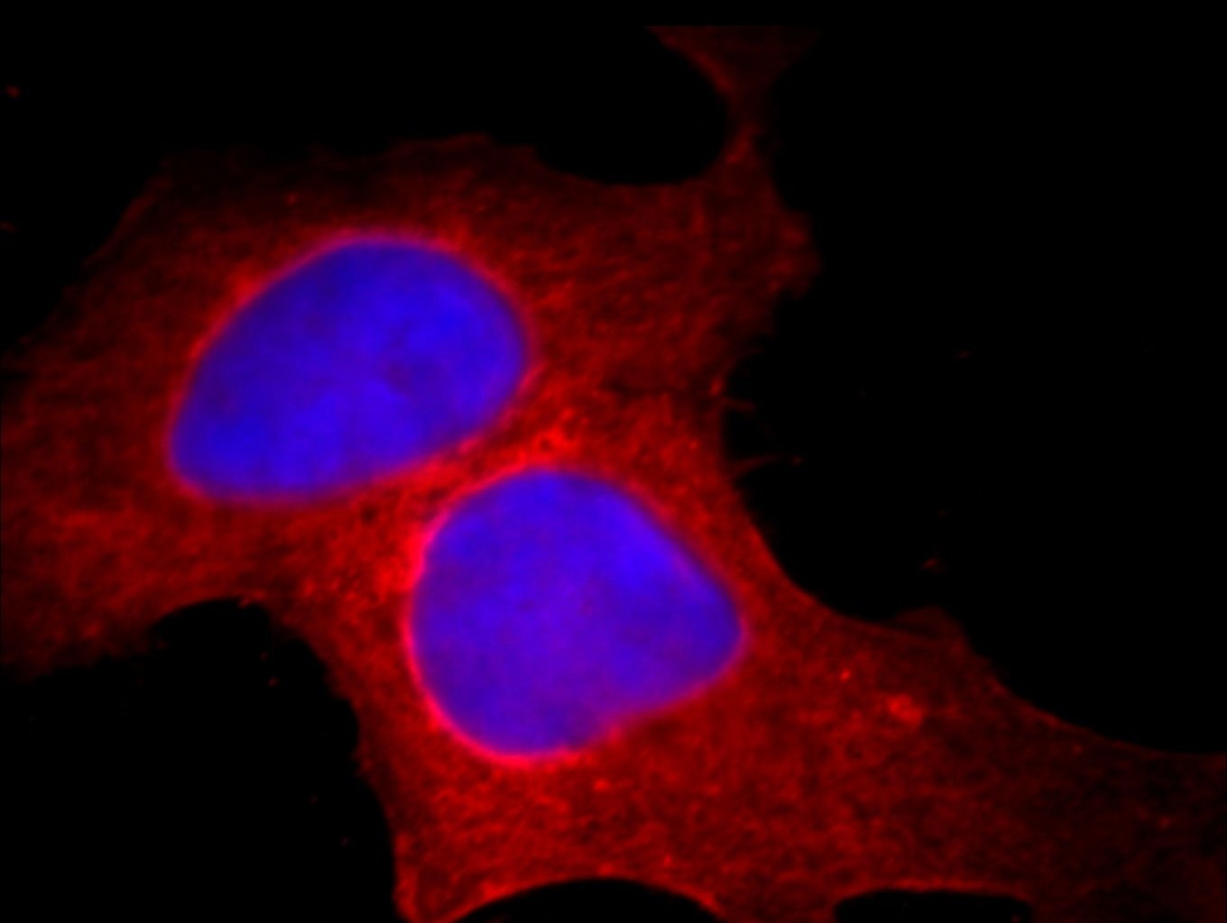Immunofluorescence (IF) / fluorescent staining of HeLa cells using Bcl-XL Monoclonal antibody (66020-1-Ig)