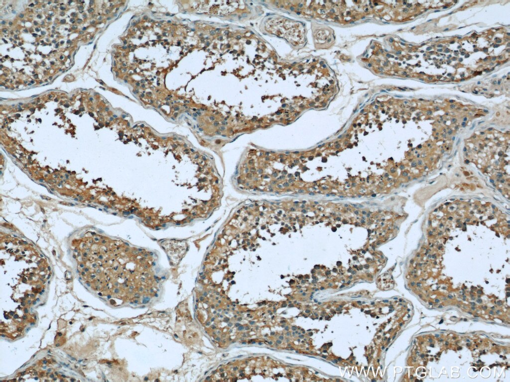 Immunohistochemistry (IHC) staining of human testis tissue using Bcl-XL Monoclonal antibody (66020-1-Ig)