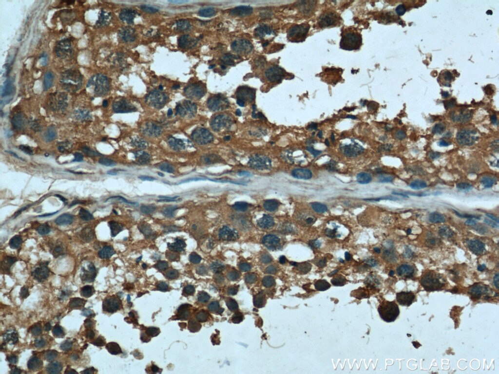 IHC staining of human testis using 66020-1-Ig