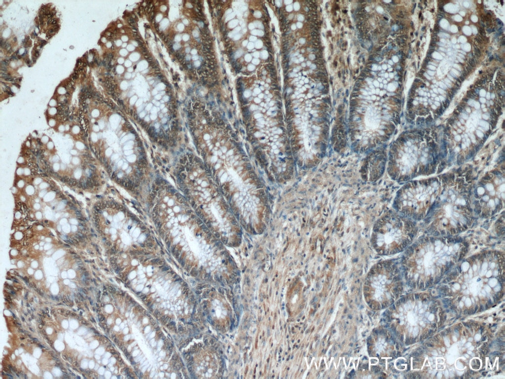 Immunohistochemistry (IHC) staining of human colon tissue using Bcl-XL Monoclonal antibody (66020-1-Ig)