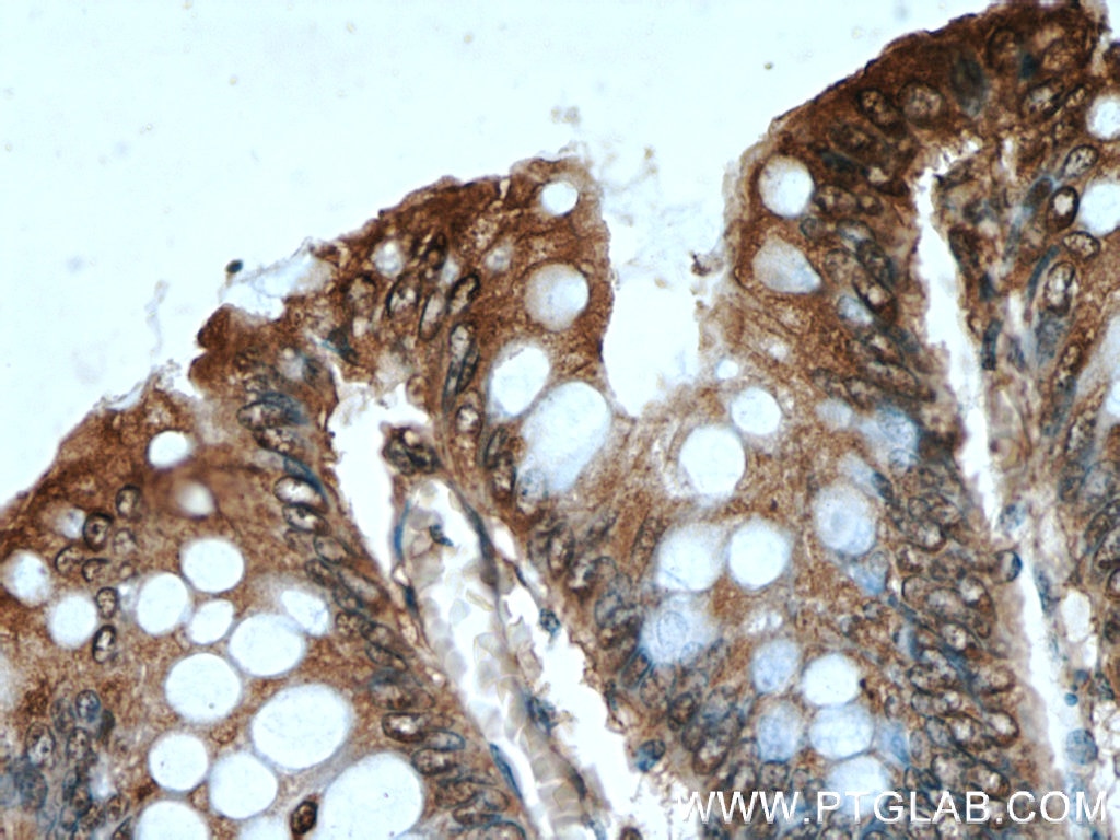 Immunohistochemistry (IHC) staining of human colon tissue using Bcl-XL Monoclonal antibody (66020-1-Ig)