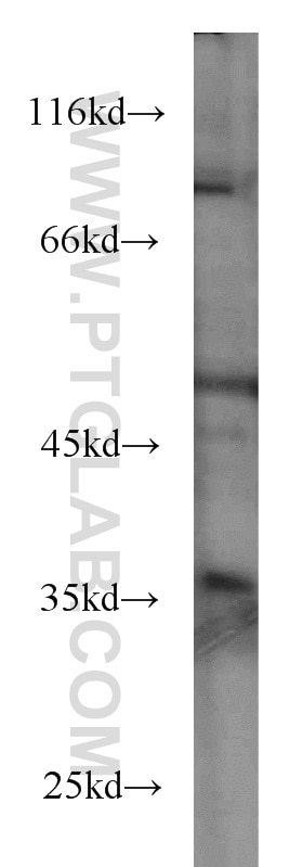 WB analysis of A431 using 66020-1-Ig