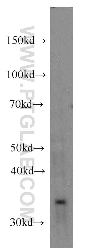 WB analysis of HeLa using 66020-1-Ig