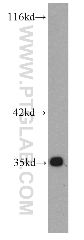 Western Blot (WB) analysis of Jurkat cells using Bcl-XL Monoclonal antibody (66020-1-Ig)