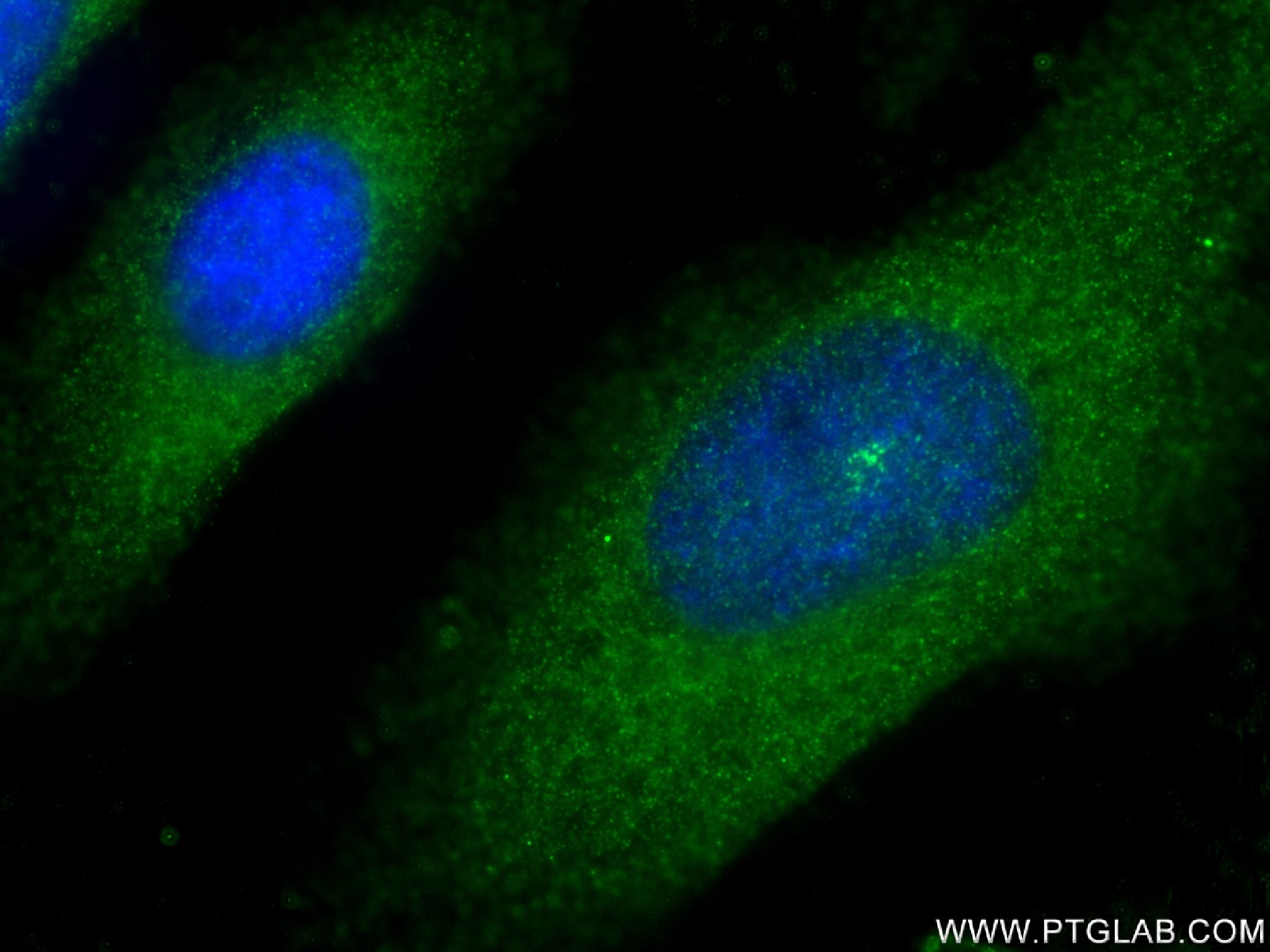 Immunofluorescence (IF) / fluorescent staining of HeLa cells using Bcl-XL Recombinant antibody (83330-1-RR)