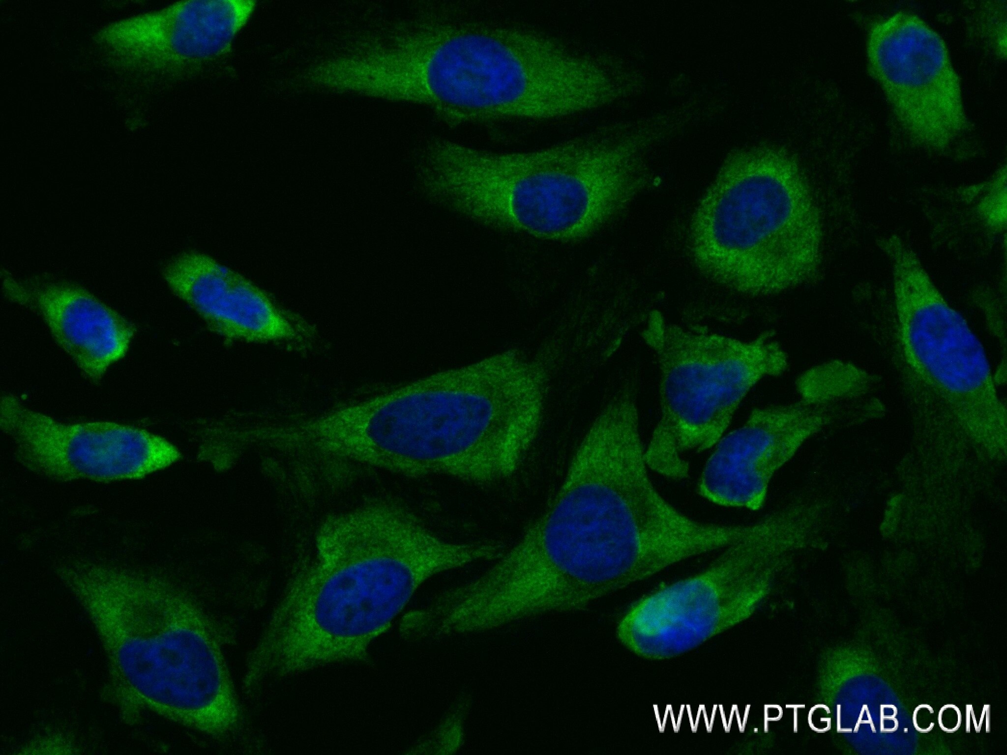 Immunofluorescence (IF) / fluorescent staining of HeLa cells using Bcl-xL Recombinant antibody (83330-2-RR)