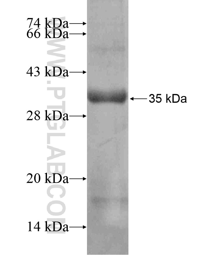 Bcl-xL fusion protein Ag18037 SDS-PAGE