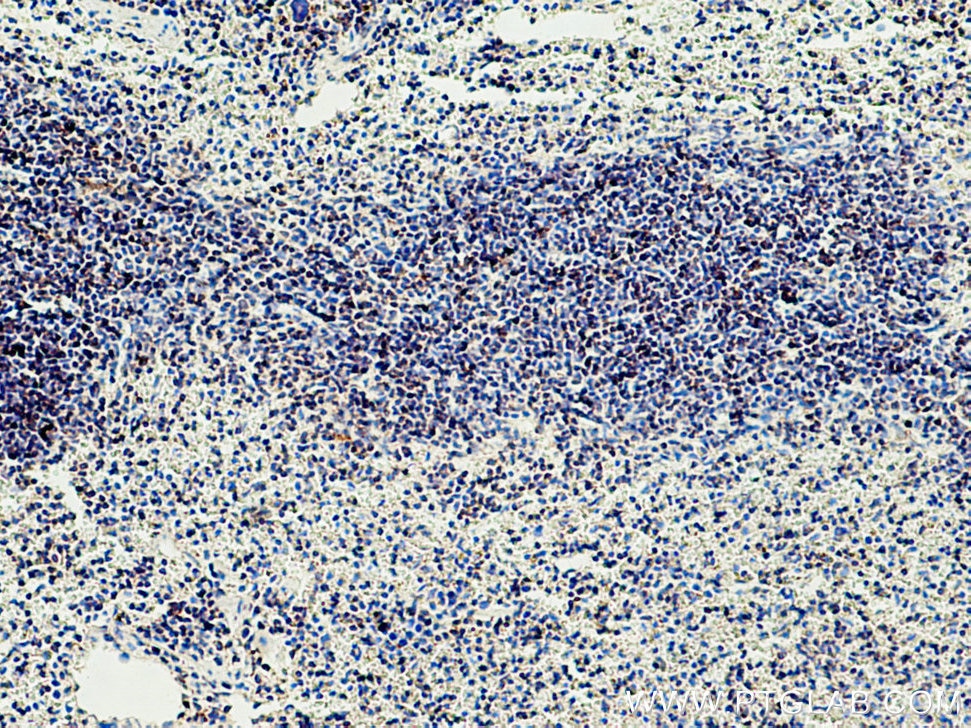 Immunohistochemistry (IHC) staining of mouse spleen tissue using Bcl2 Polyclonal antibody (26593-1-AP)