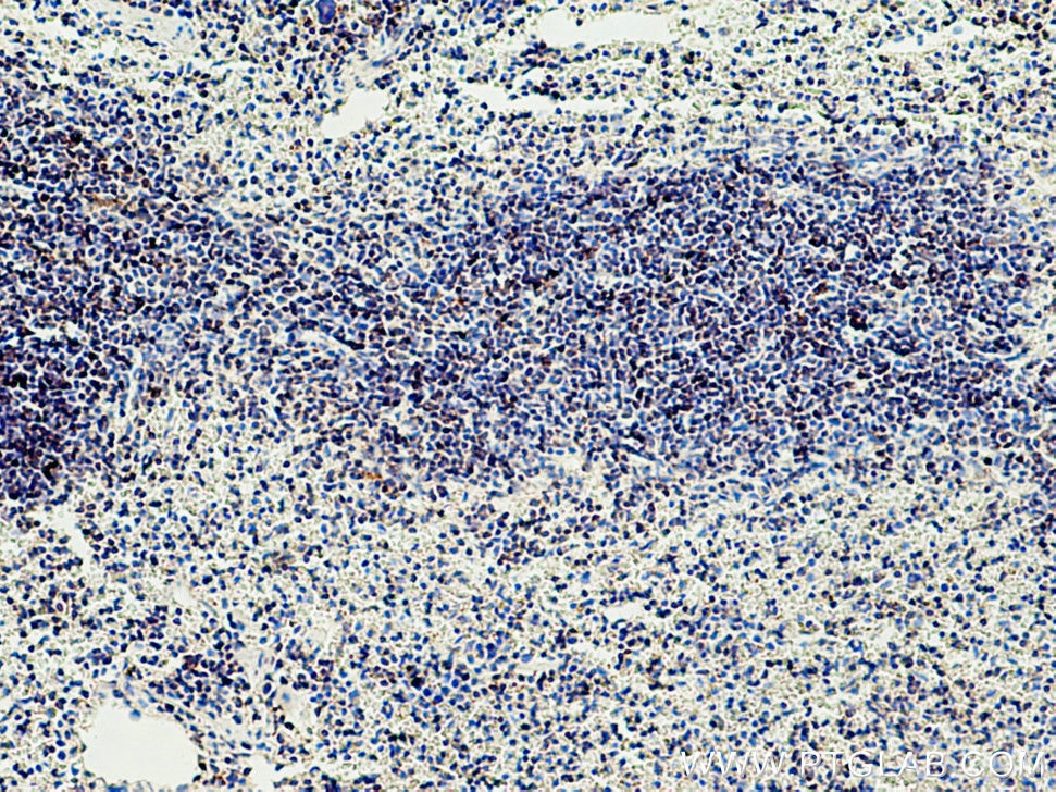 IHC staining of mouse spleen using 26593-1-AP