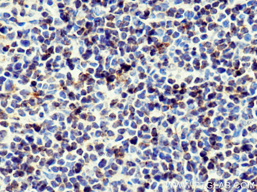 Immunohistochemistry (IHC) staining of mouse spleen tissue using Bcl2 Polyclonal antibody (26593-1-AP)