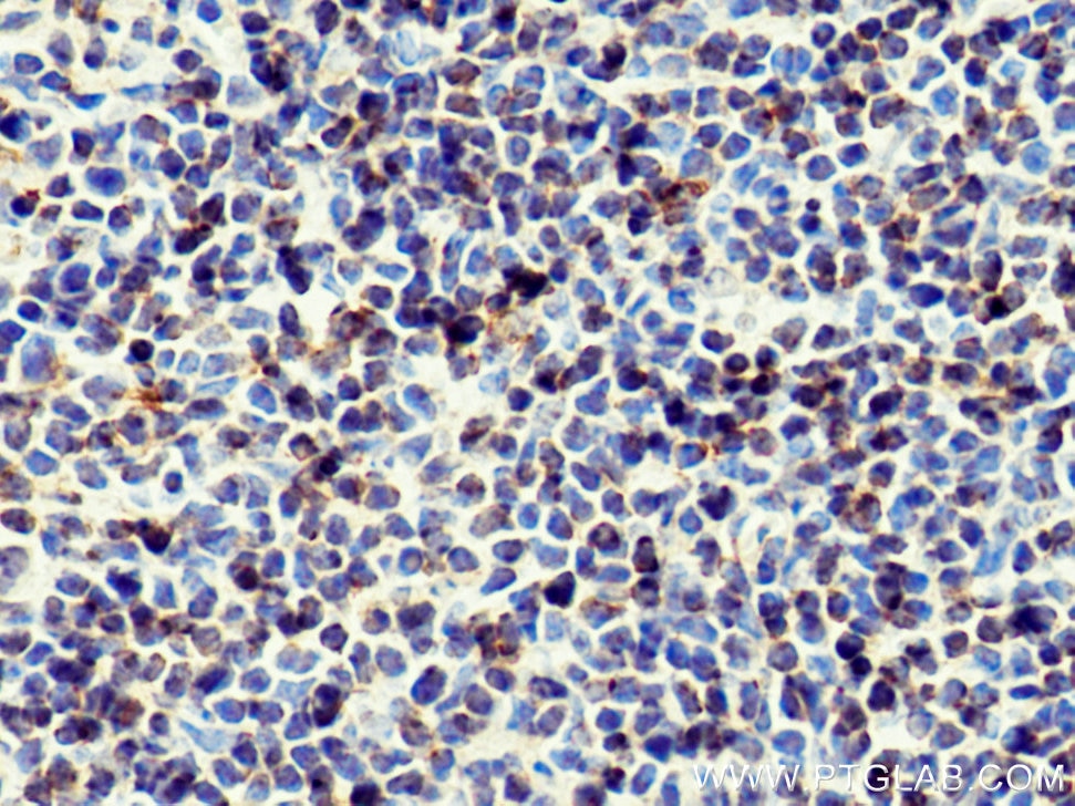 IHC staining of mouse spleen using 26593-1-AP