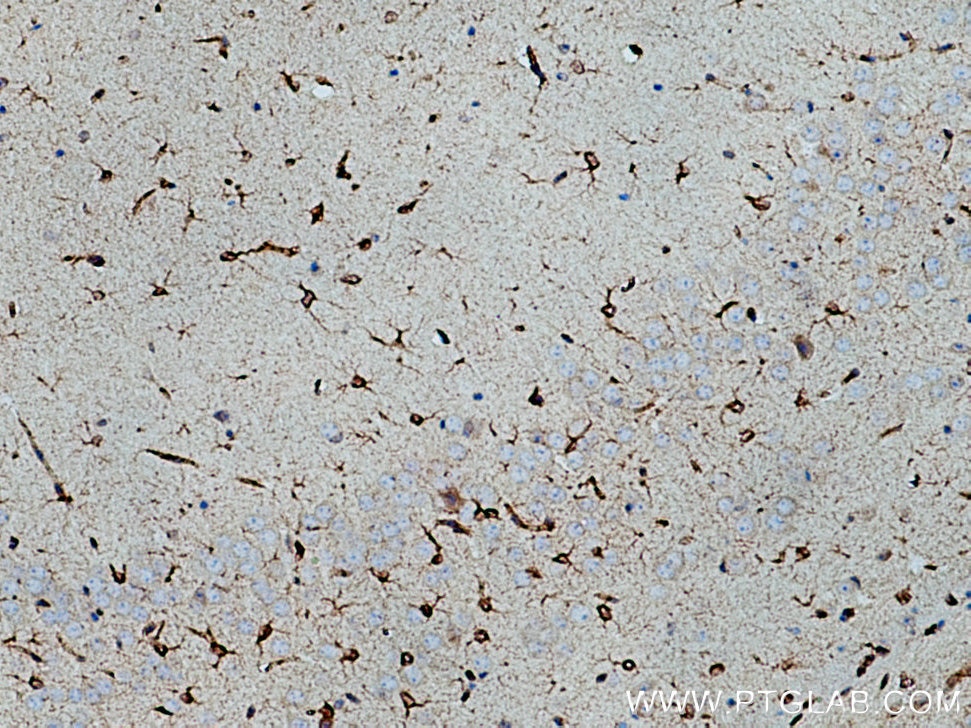 Immunohistochemistry (IHC) staining of mouse brain tissue using Bcl2 Polyclonal antibody (26593-1-AP)