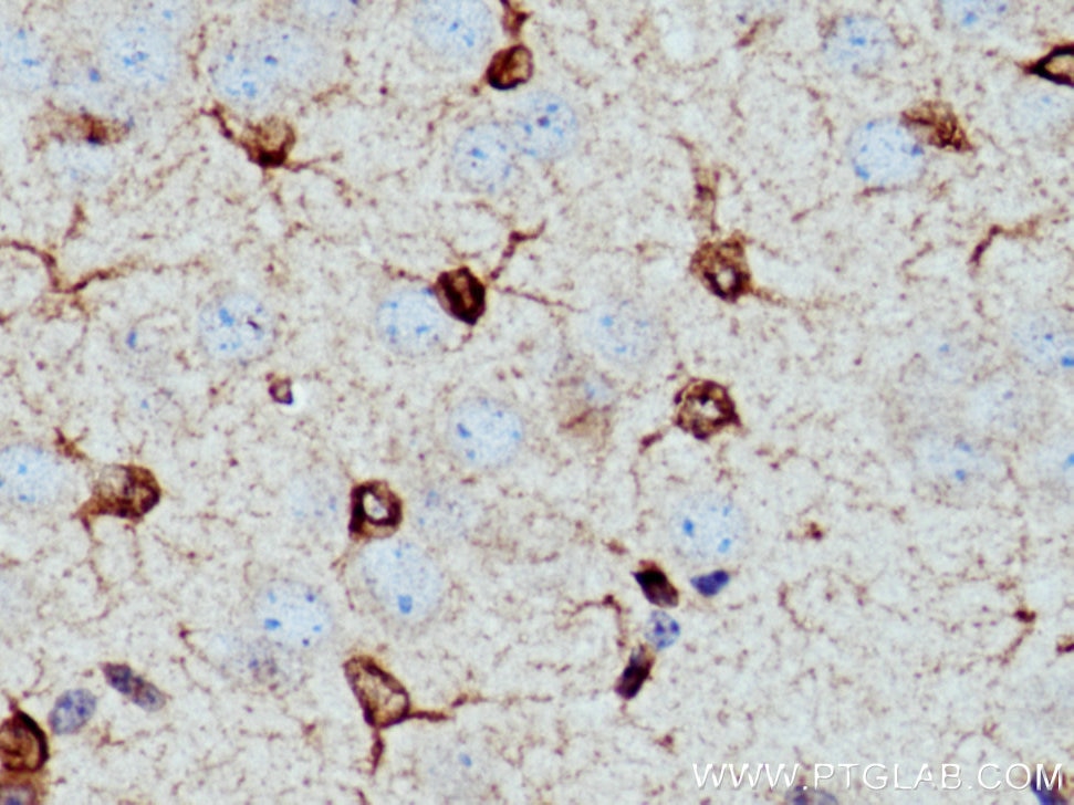 Immunohistochemistry (IHC) staining of mouse brain tissue using Bcl2 Polyclonal antibody (26593-1-AP)