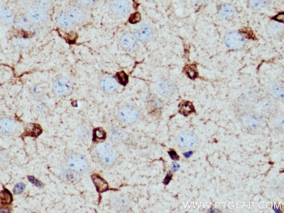 IHC staining of mouse brain using 26593-1-AP