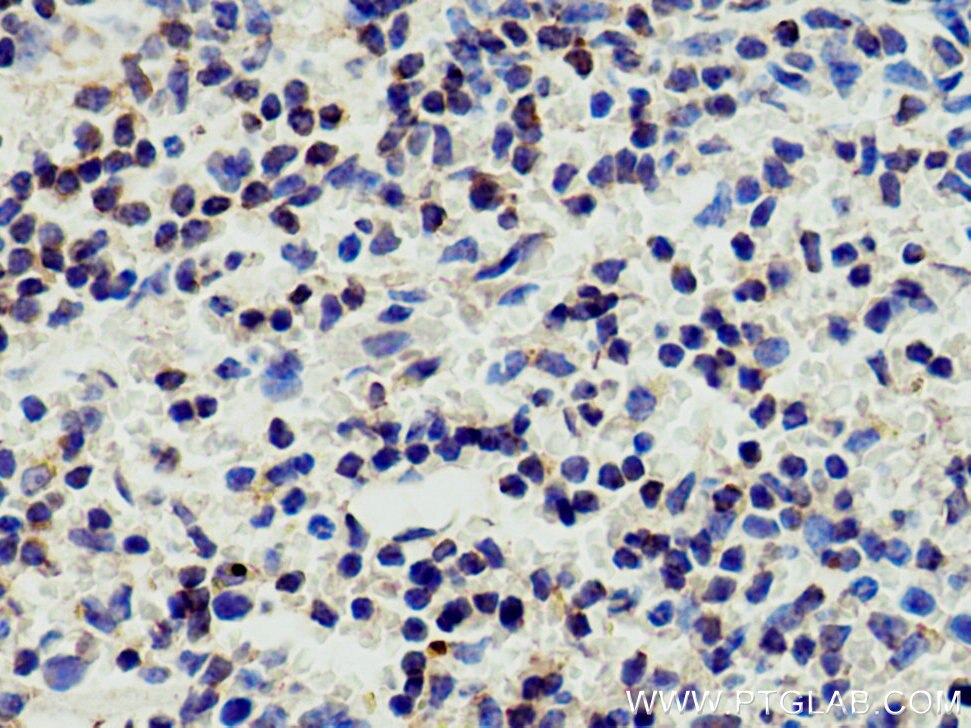 Immunohistochemistry (IHC) staining of mouse spleen tissue using Bcl2 Polyclonal antibody (26593-1-AP)