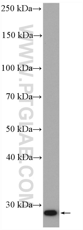 Western Blot (WB) analysis of mouse testis tissue using Bcl2 Polyclonal antibody (26593-1-AP)