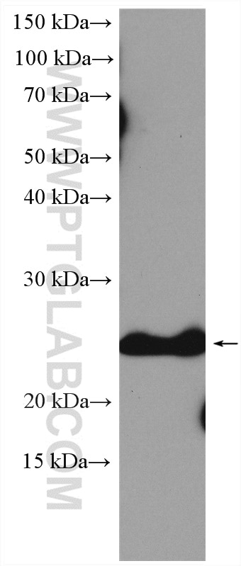 Western Blot (WB) analysis of mouse heart tissue using Bcl2 Polyclonal antibody (26593-1-AP)