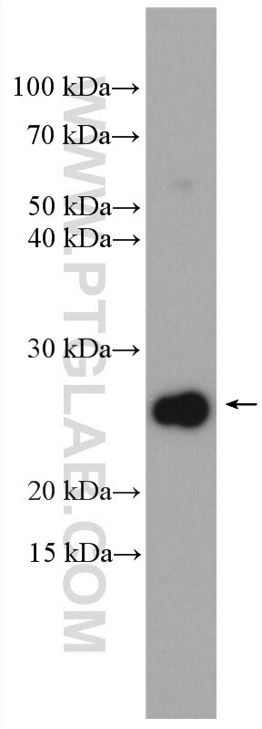 Western Blot (WB) analysis of C2C12 cells using Bcl2 Polyclonal antibody (26593-1-AP)