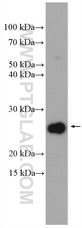 WB analysis of C2C12 using 26593-1-AP