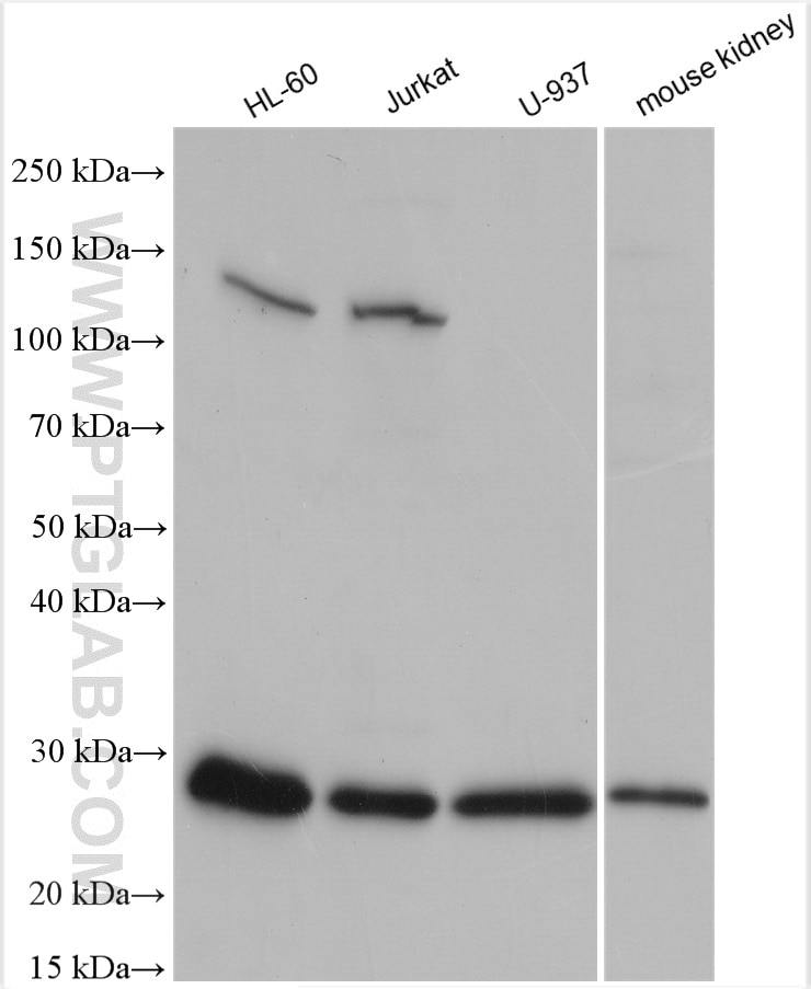 Western Blot (WB) analysis of various lysates using Bcl2 Polyclonal antibody (26593-1-AP)