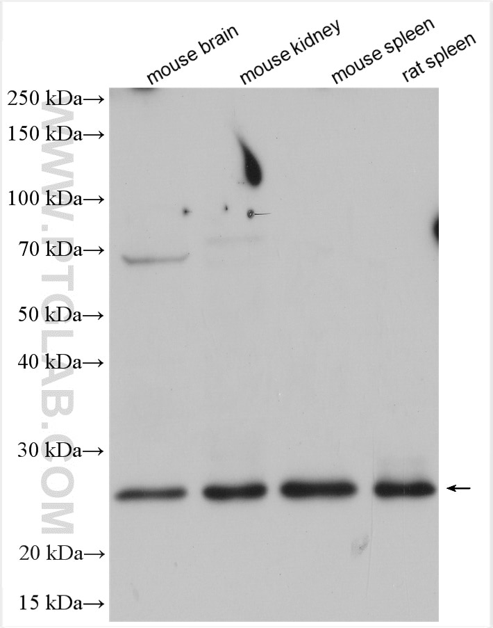 Western Blot (WB) analysis of various lysates using Bcl2 Polyclonal antibody (26593-1-AP)