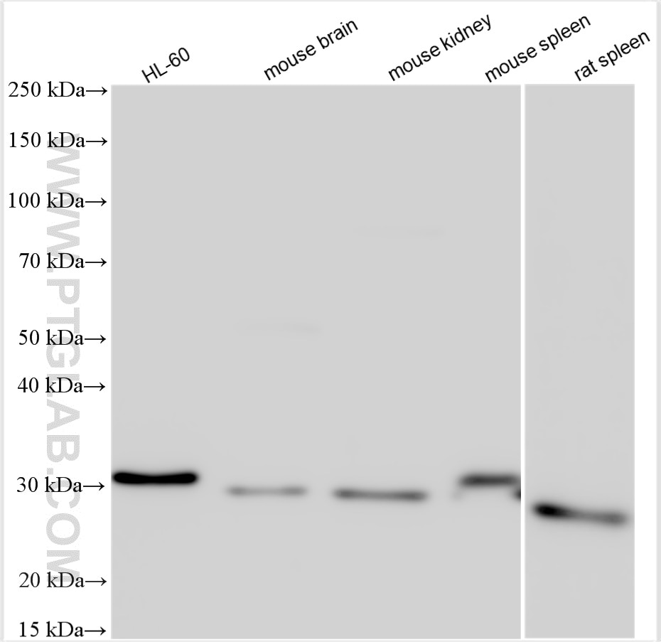 Western Blot (WB) analysis of various lysates using Bcl2 Polyclonal antibody (26593-1-AP)