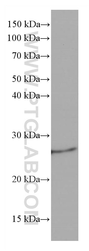 Western Blot (WB) analysis of mouse brain tissue using Bcl2 Monoclonal antibody (66799-1-Ig)