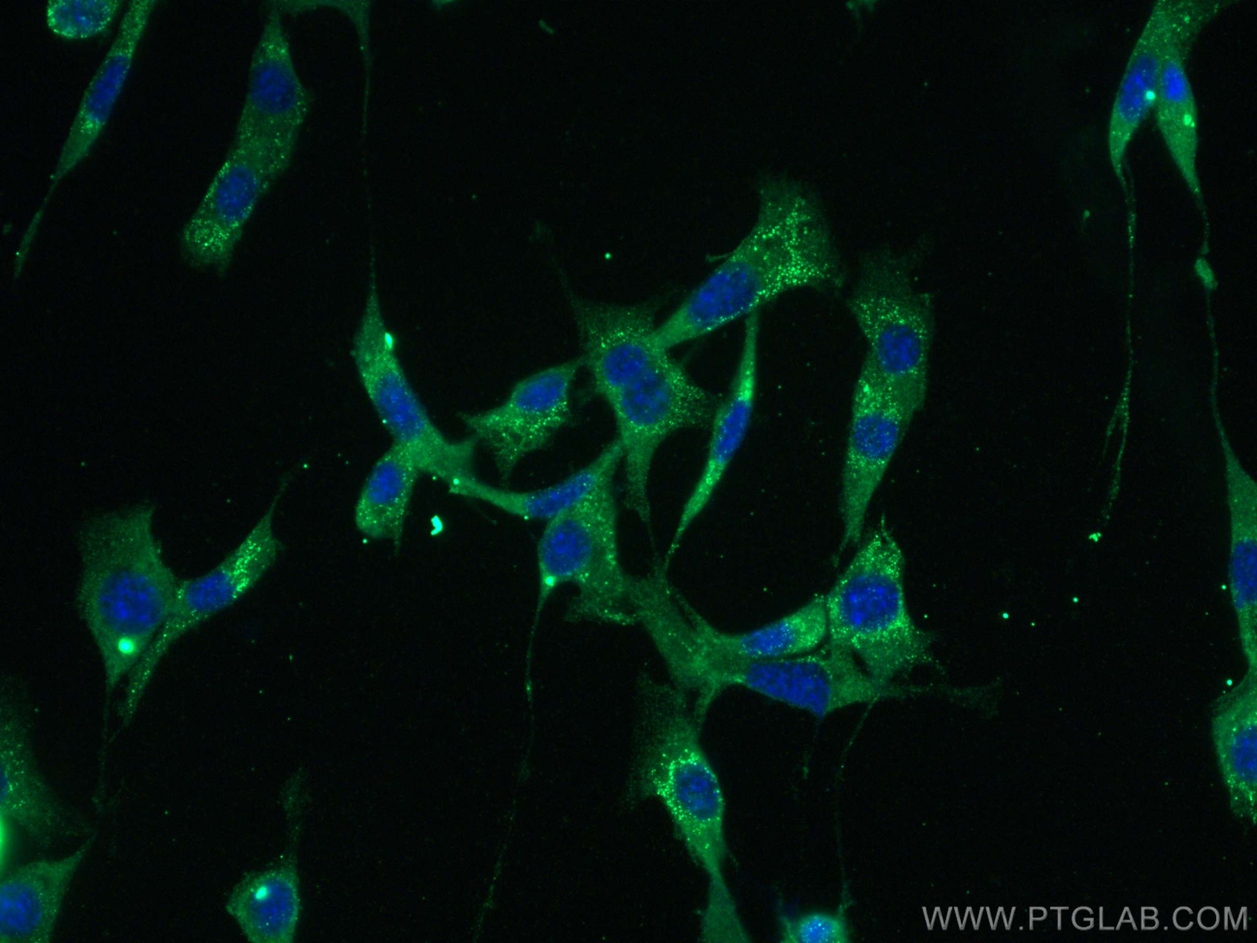 IF Staining of NIH/3T3 using 68103-1-Ig