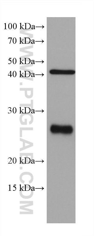 Western Blot (WB) analysis of C2C12 cells using mouse Bcl2 Monoclonal antibody (68103-1-Ig)