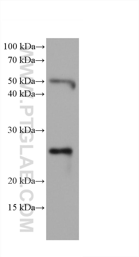 WB analysis of mouse spleen using 68103-1-Ig