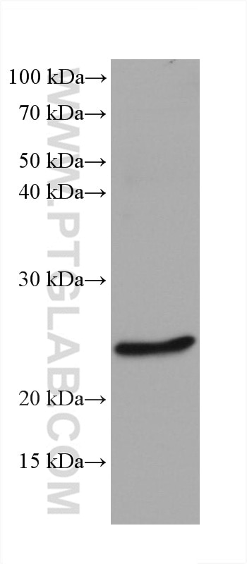 Western Blot (WB) analysis of mouse brain tissue using mouse Bcl2 Monoclonal antibody (68103-1-Ig)