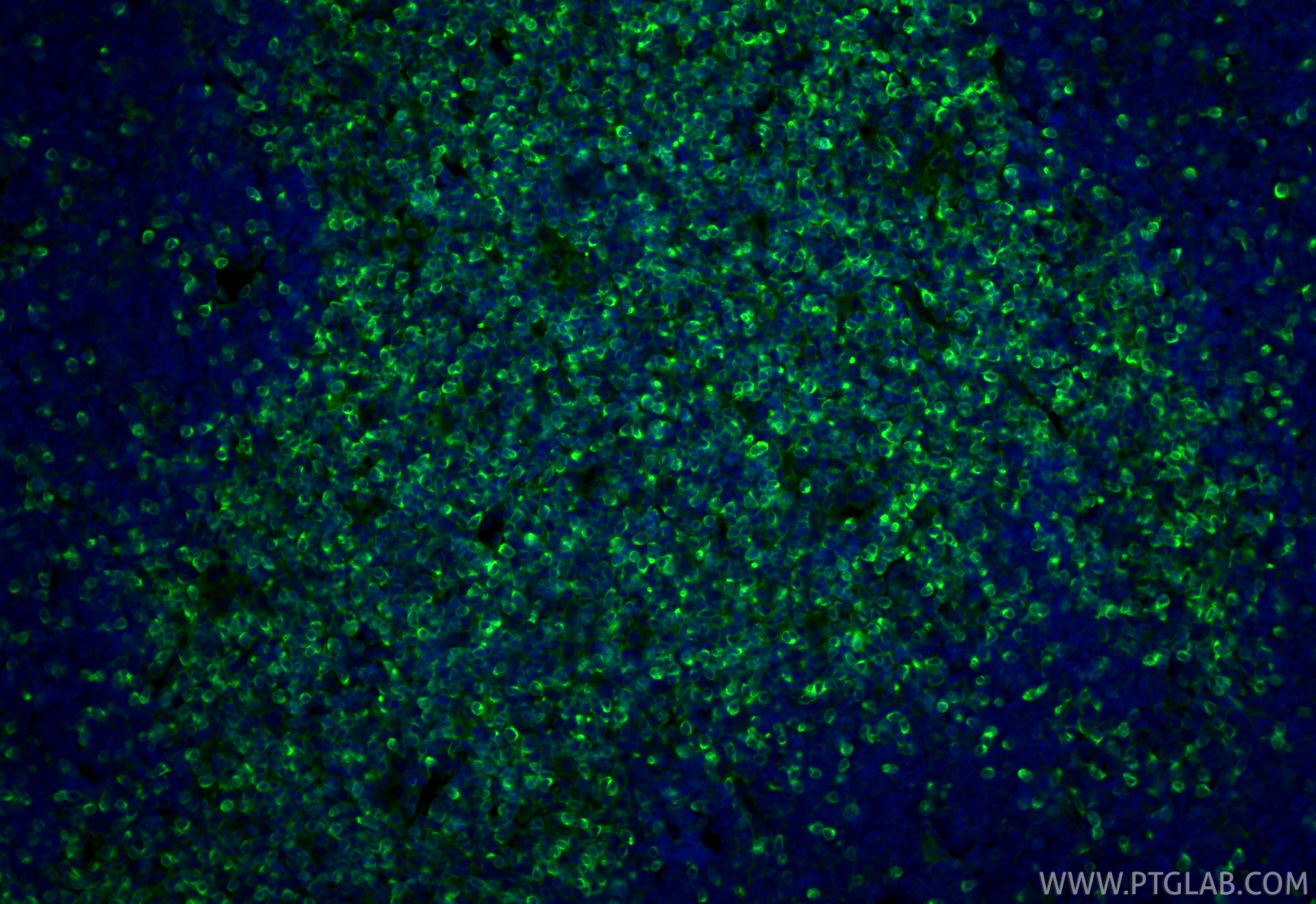Immunofluorescence (IF) / fluorescent staining of mouse thymus tissue using Bcl2 Recombinant monoclonal antibody (82469-6-RR)