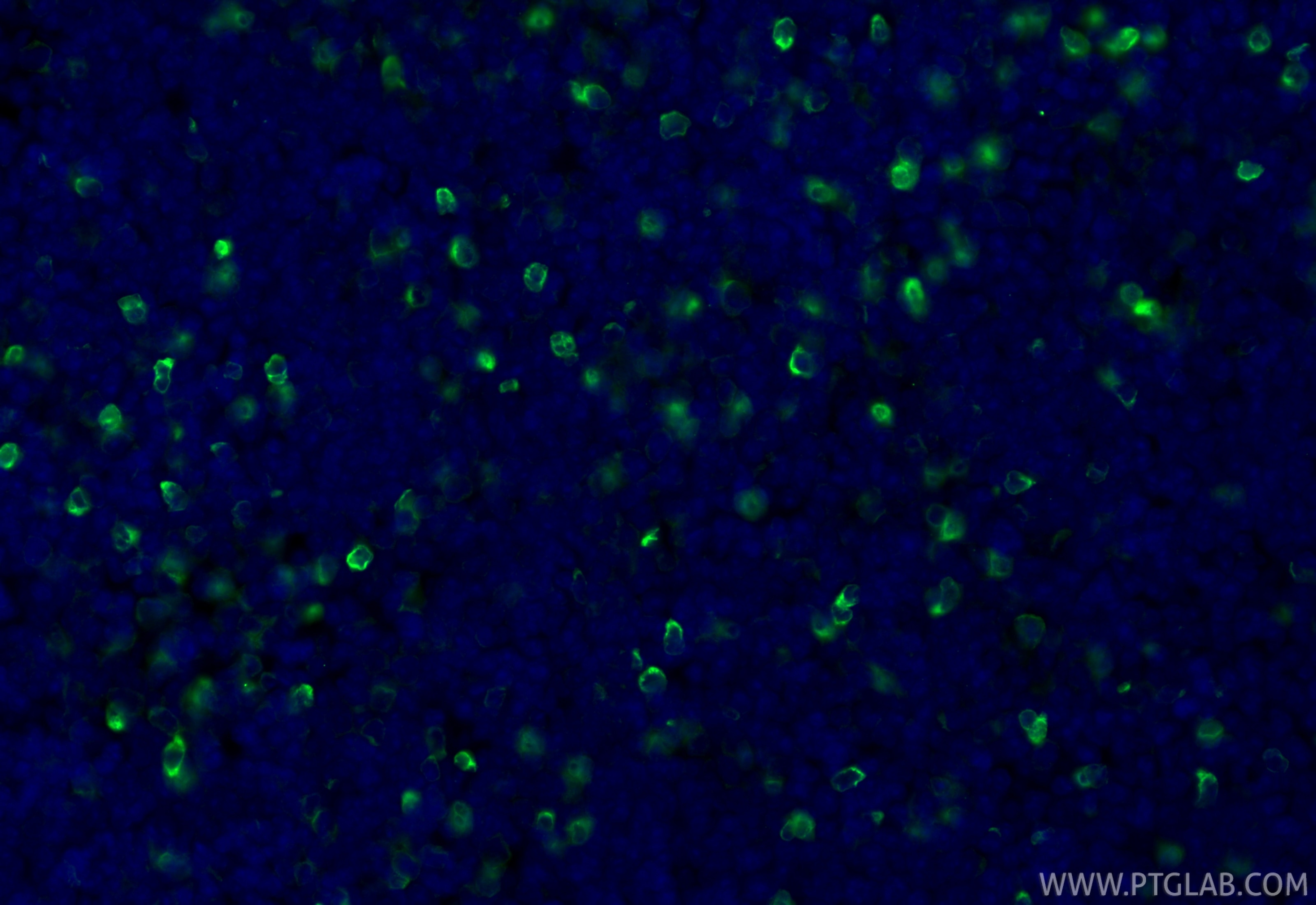 Immunofluorescence (IF) / fluorescent staining of mouse thymus tissue using Bcl2 Recombinant monoclonal antibody (82469-6-RR)
