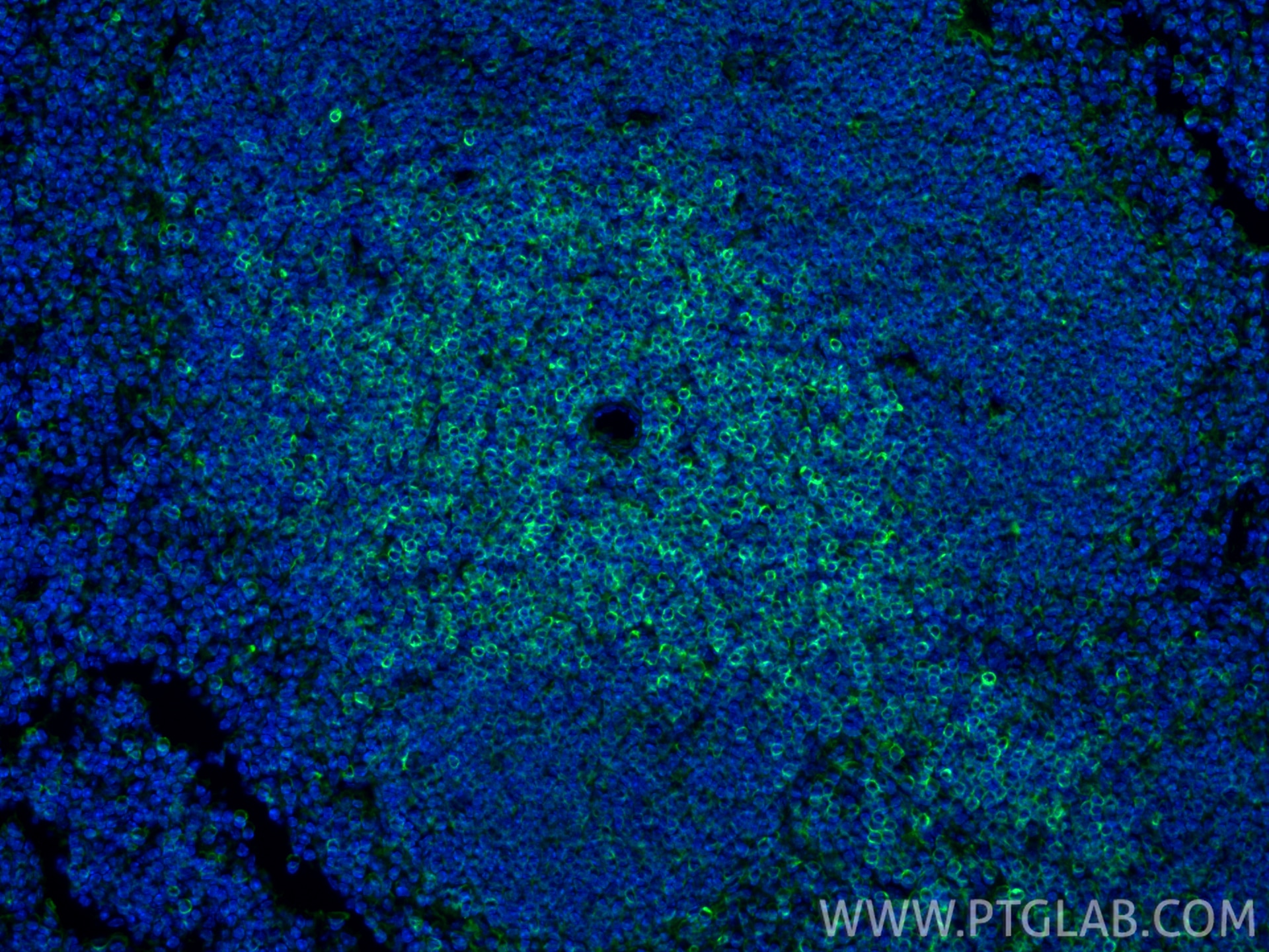 Immunofluorescence (IF) / fluorescent staining of mouse spleen tissue using Bcl2 Recombinant monoclonal antibody (82469-6-RR)