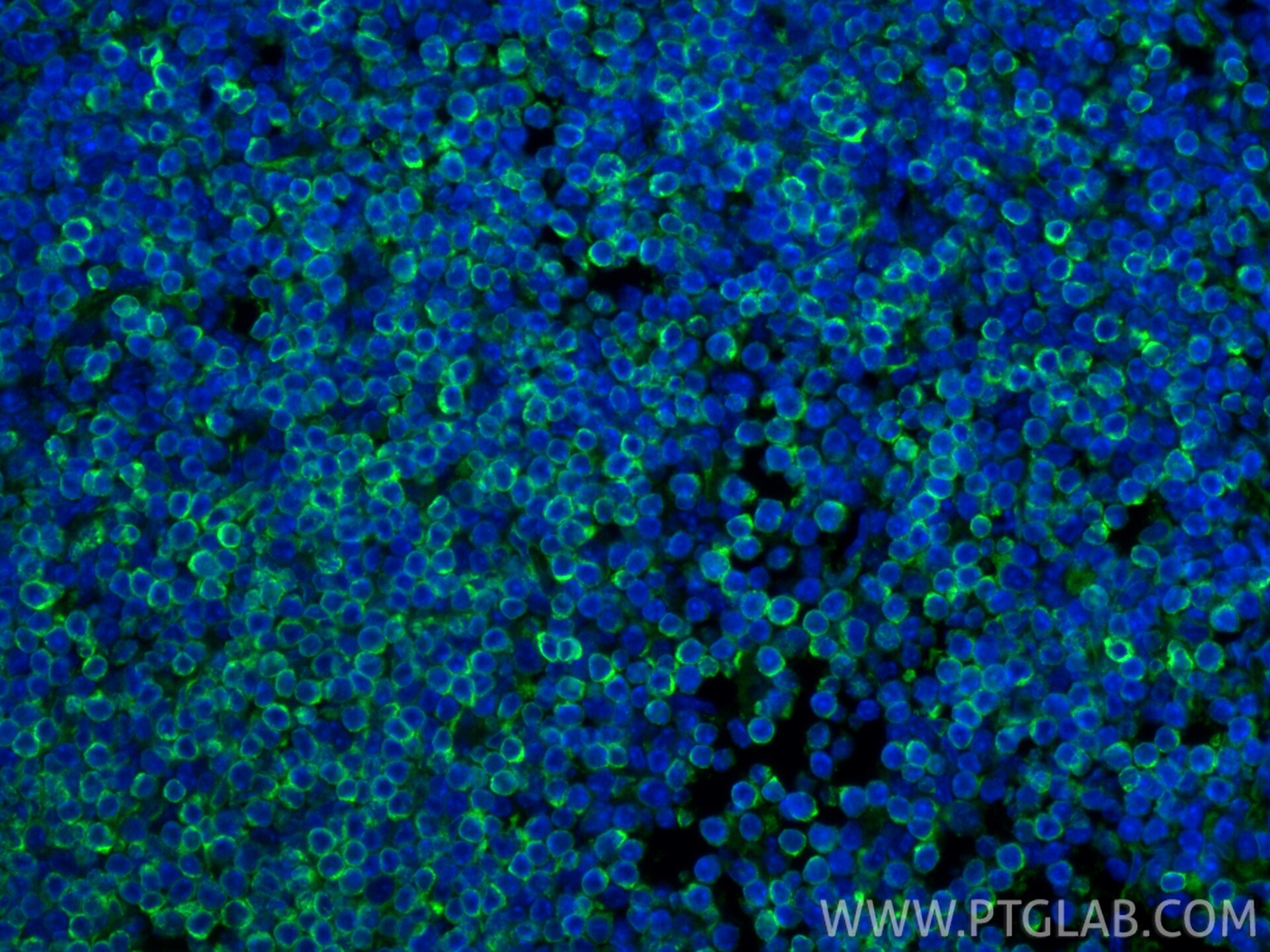 Immunofluorescence (IF) / fluorescent staining of mouse spleen tissue using Bcl2 Recombinant monoclonal antibody (82469-6-RR)