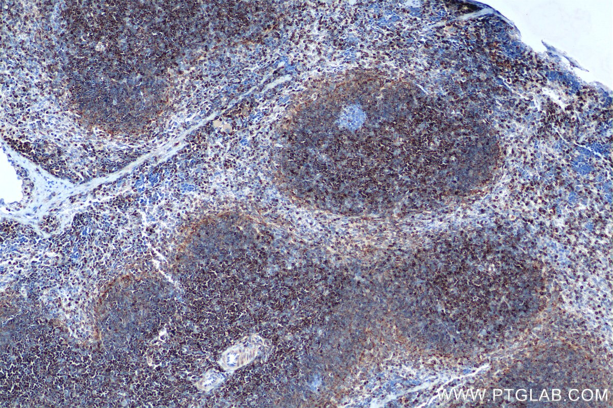Immunohistochemistry (IHC) staining of mouse spleen tissue using Bcl2 Recombinant antibody (82469-6-RR)